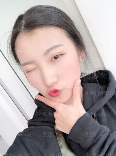 肖鸿双眼皮介绍