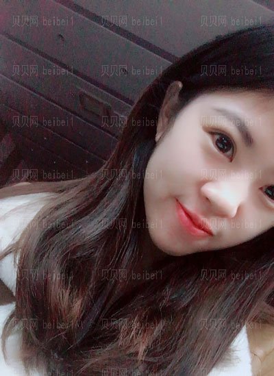 徐海艇双眼皮手术失败率高吗?技术怎么样
