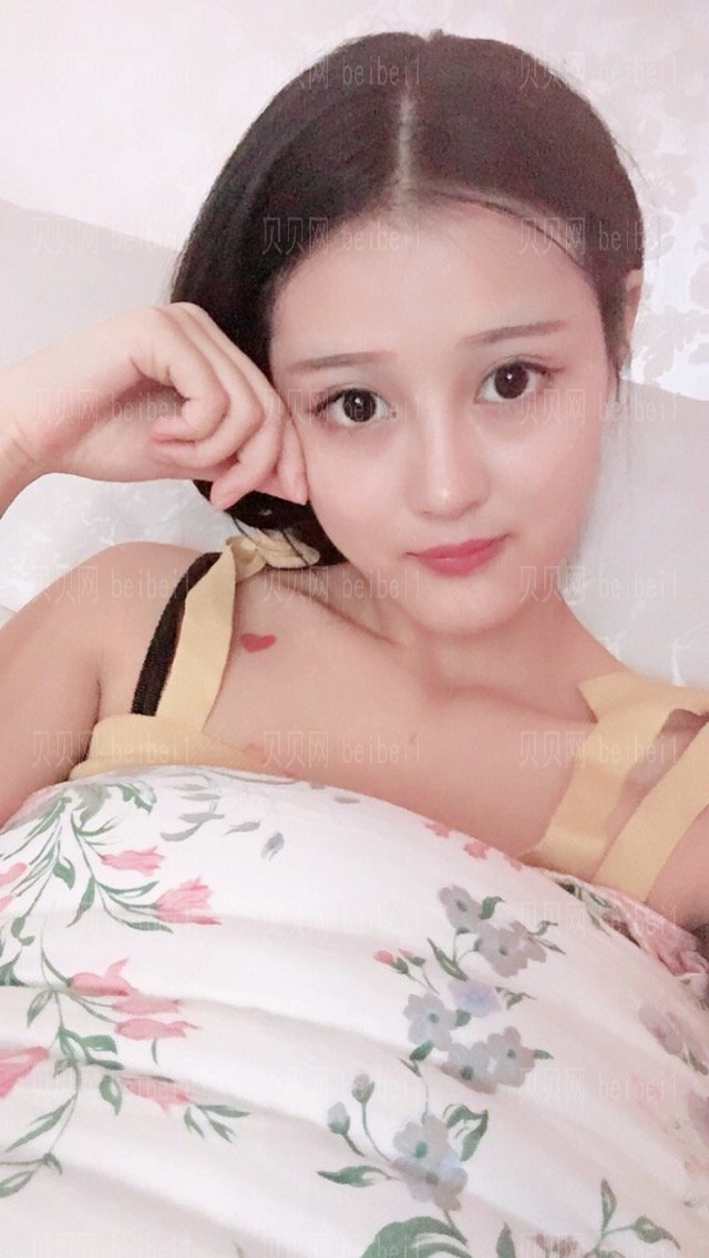 自体脂肪多方面部填充术后第216天了，周末你们一般干嘛去呢？