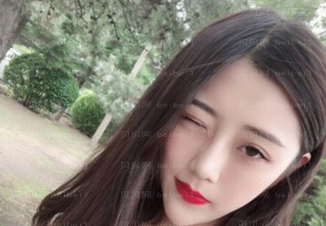 九院张英去眼袋介绍好不好看?