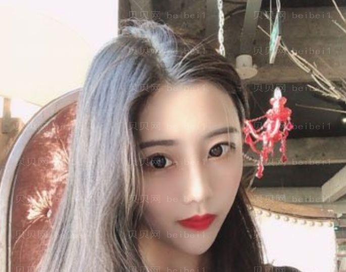 九院张英去眼袋介绍好不好看?