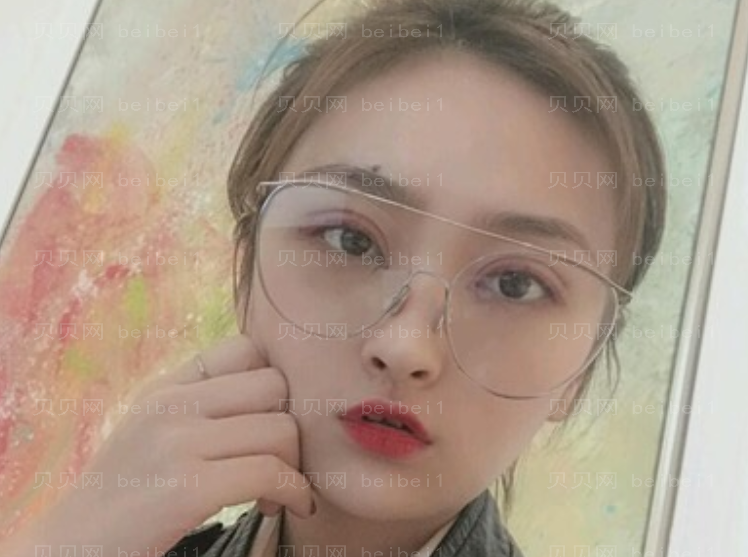 刘晓吉双眼皮介绍