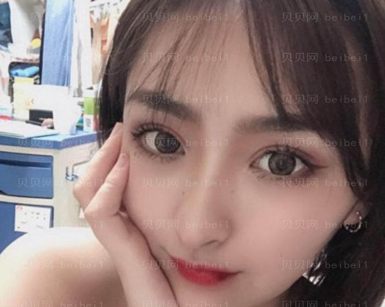 刘晓吉双眼皮介绍