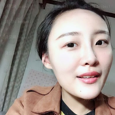 庞东剑做的隆鼻手术怎么样