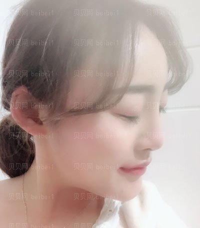 庞东剑做的隆鼻手术怎么样