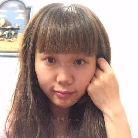 重庆郑荃丽格医疗美容李敏光子嫩肤介绍