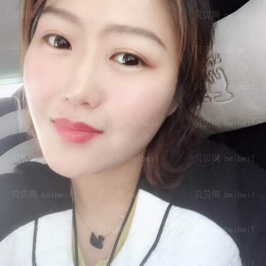 重庆郑荃丽格医疗美容李敏光子嫩肤介绍