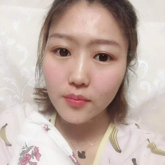重庆郑荃丽格医疗美容李敏光子嫩肤介绍