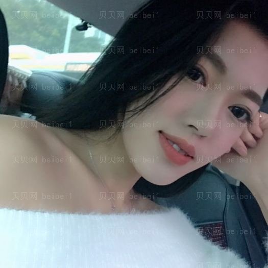 重庆郑荃丽格医疗美容李若嫣激光祛斑介绍