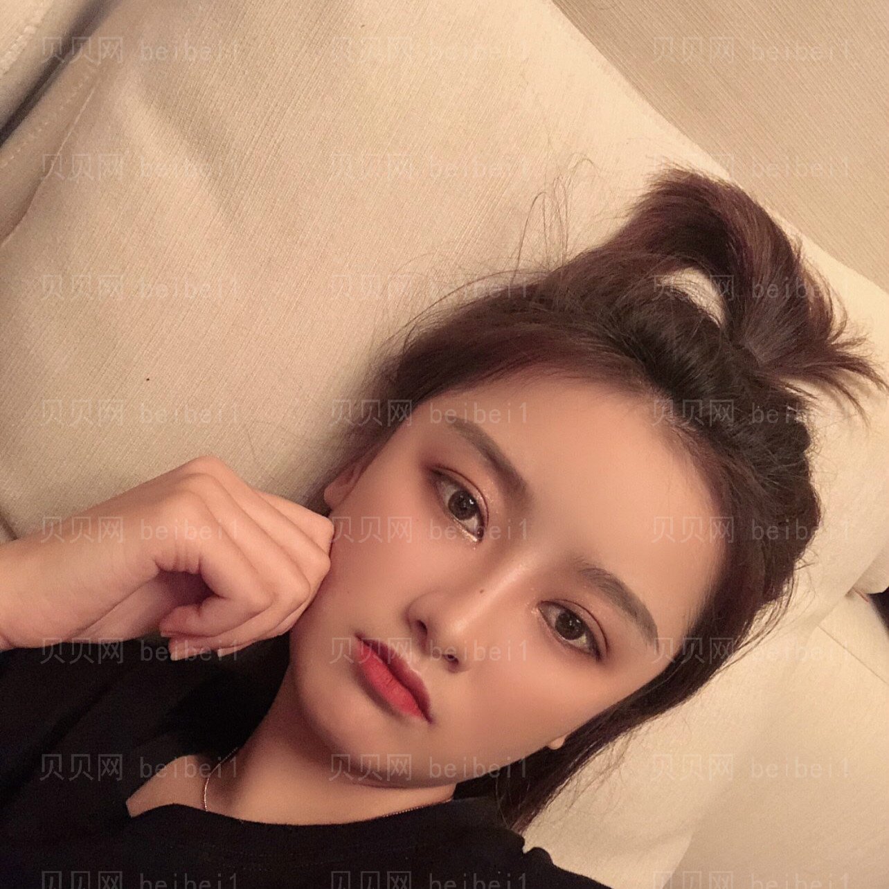 重庆郑荃丽格医疗美容刘永涛切开双眼皮介绍
