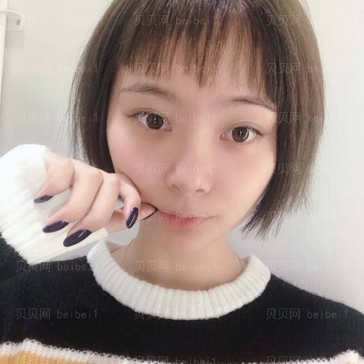 重庆艺星整形医院汪飞光子嫩肤介绍