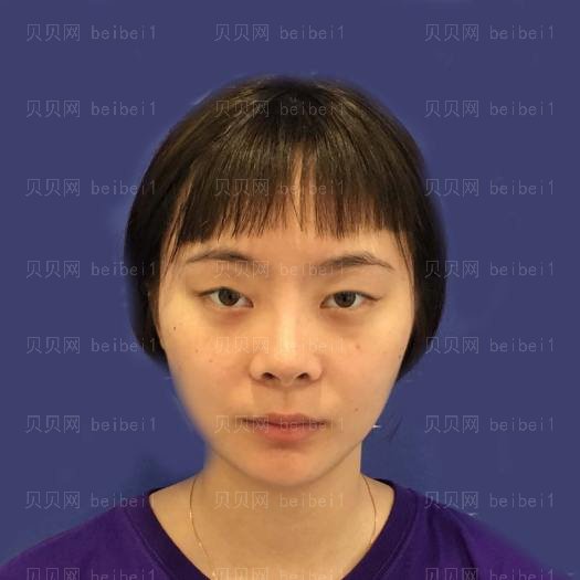 重庆艺星整形医院汪飞光子嫩肤介绍