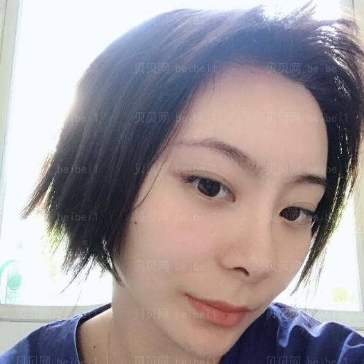 重庆艺星整形医院汪飞光子嫩肤介绍