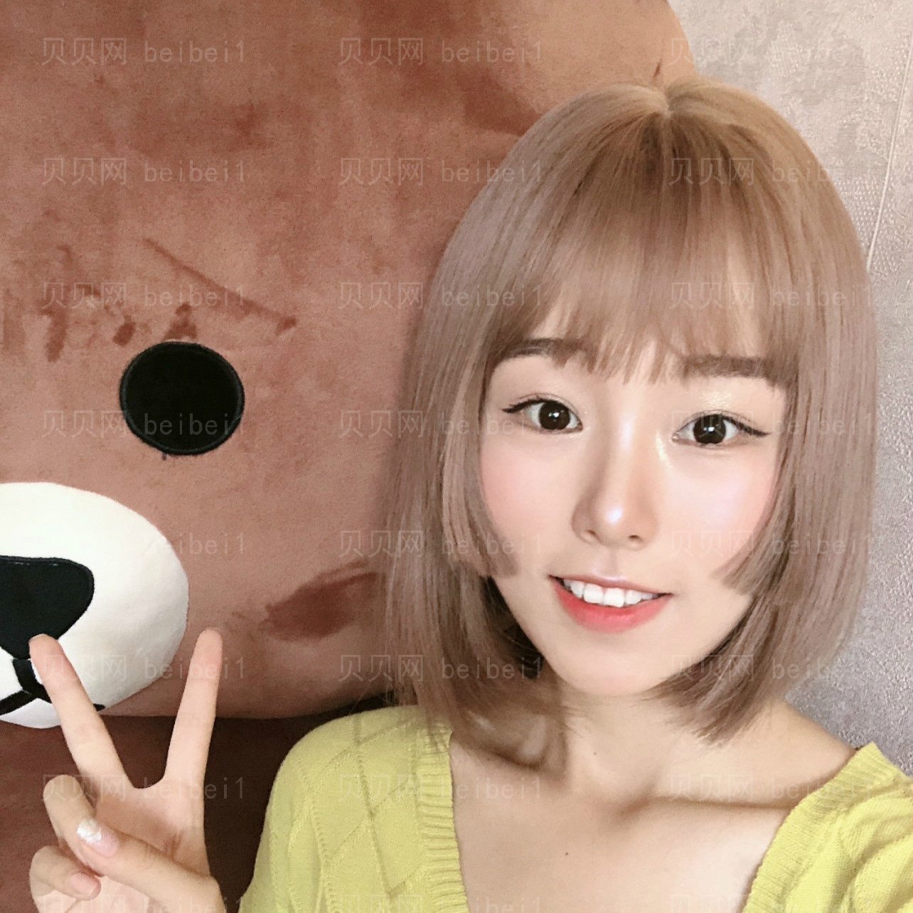 重庆艺星整形医院王方鹏全切双眼皮介绍
