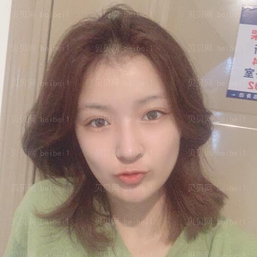 重庆艺星整形医院赵莉光子嫩肤介绍