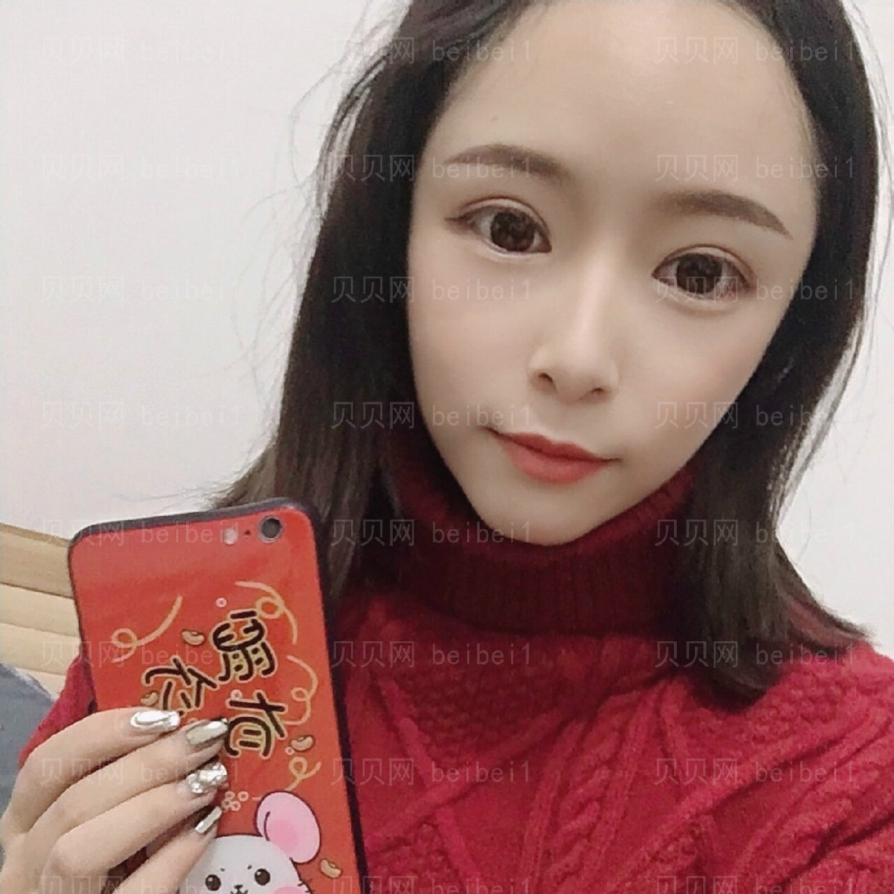 重庆徐铎丽格唐建奇全切双眼皮介绍