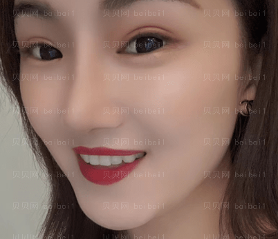 上海华美医疗美容医院李健鼻部手术介绍