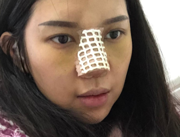 上海华美医疗美容医院李健眼鼻部手术介绍