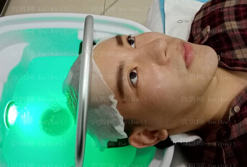 上海时光整形外科医院李桂海头发种植介绍