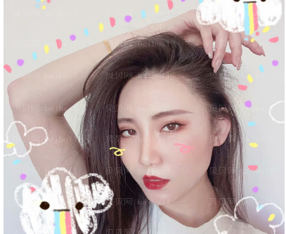 上海翔茂医疗美容门诊部钟卫民玻尿酸隆鼻介绍