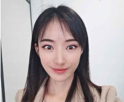 上海翔茂医疗美容门诊部钟卫民光子嫩肤介绍