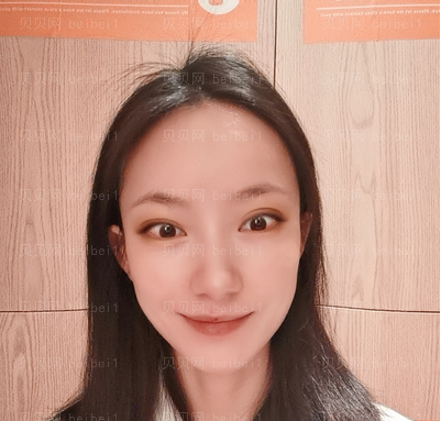 上海翔茂医疗美容门诊部钟卫民光子嫩肤介绍