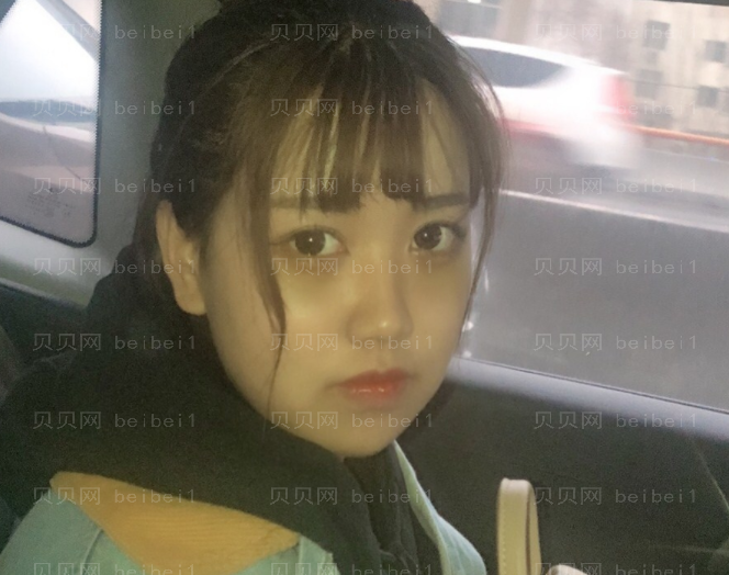 上海时光整形外科医院姚全豊颧骨整形介绍