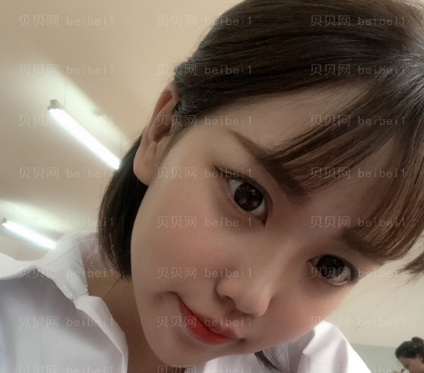 上海时光整形外科医院姚全豊颧骨整形介绍