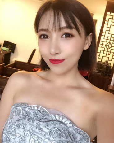 上海华美_张朋医生_半肋骨隆鼻+自体脂肪填充_介绍分享~