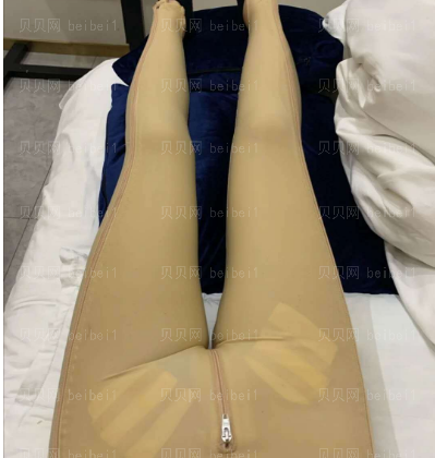 上海翔茂医疗美容门诊部赖仕原腿部吸脂介绍