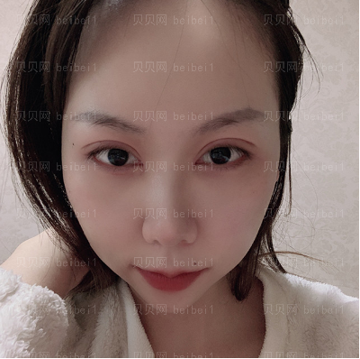 上海翔茂医疗美容门诊部赖仕原眼线修复介绍