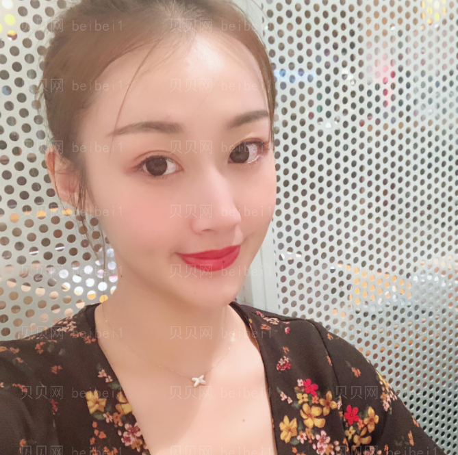上海时光_刘佳东医生_埋线提升介绍分享!