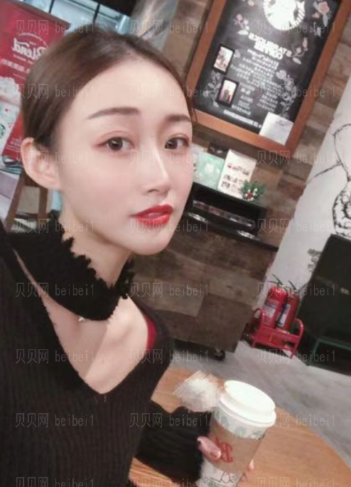 上海时光_刘佳东医生_埋线提升介绍分享!