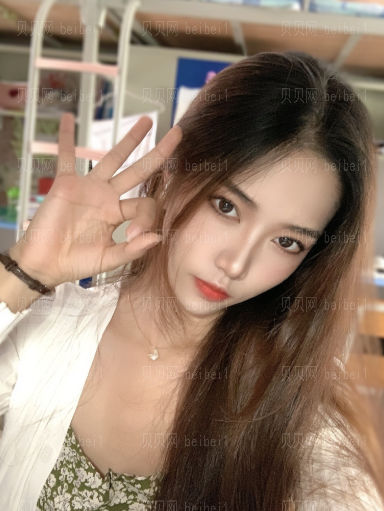 上海时光_张晶医生_微创双眼皮+开眼角_术后果分享!
