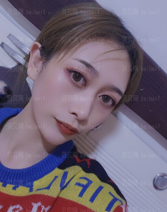 上海时光_张晓梅医生_面部埋线提升_分享!