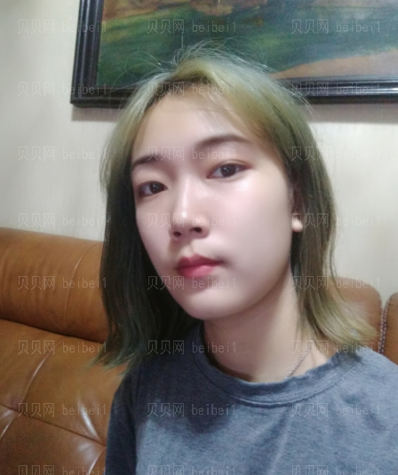 上海和睦家整形医院陈磊玻尿酸除皱介绍