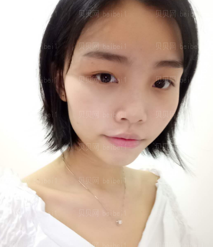 上海和睦家整形医院陆毅彩光祛斑介绍
