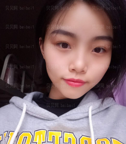 上海和睦家整形医院陆毅彩光祛斑介绍