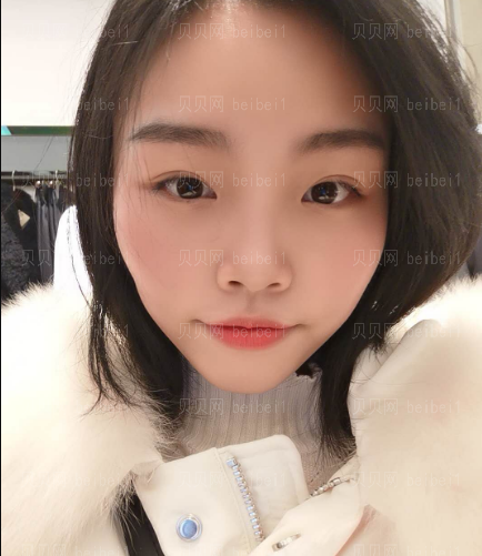 上海和睦家整形医院陆毅彩光祛斑介绍
