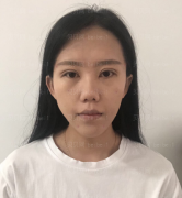 上海和睦家整形医院陆毅面部年轻化介绍