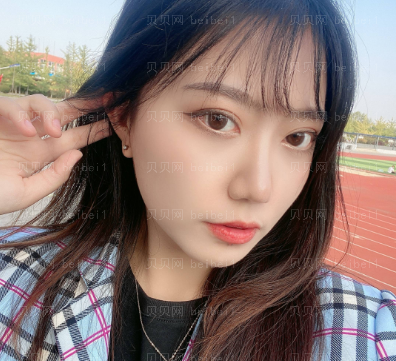 广州华美医疗美容整形医院王洪勇双眼皮介绍