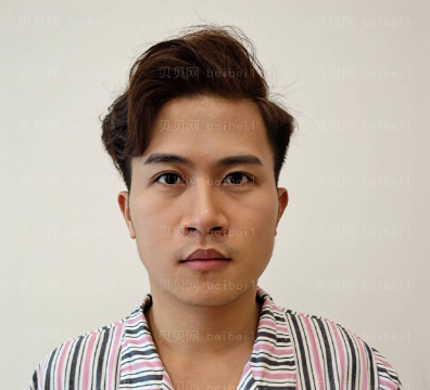广州华美医疗美容整形医院王洪勇全脸磨骨介绍