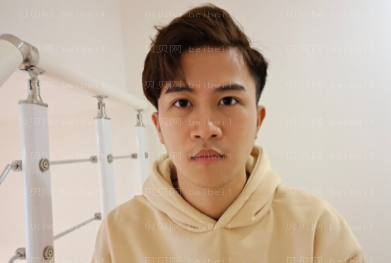 广州华美医疗美容整形医院王洪勇全脸磨骨介绍