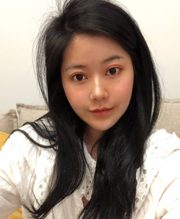 上海华美_杨亚益医生_全切双眼皮+开内眼角介绍分享!