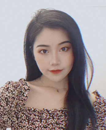 上海华美_杨亚益医生_全切双眼皮+开内眼角介绍分享!