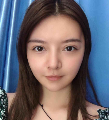 上海华美医疗美容医院杨亚益双眼皮修复介绍