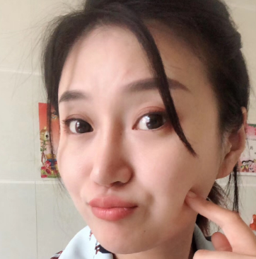 广州华美医疗美容整形医院赵晶晶除皱瘦脸介绍