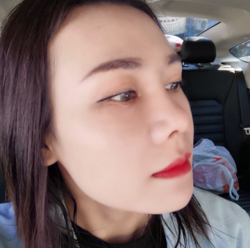 广州华美医疗美容整形医院李文锋隆鼻介绍