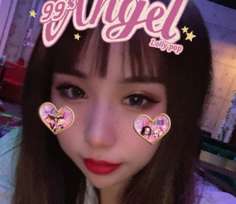 广州华美医疗美容整形医院曾高双眼皮介绍