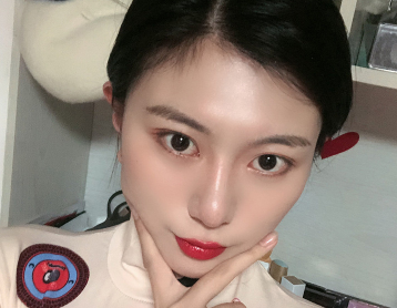 上海华美_许再荣医生_全切双眼皮+开眼角+上睑提肌_介绍分享!